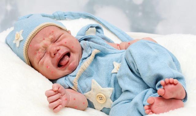 进入秋冬季, 宝宝皮肤易出现小红点咋办? 七大