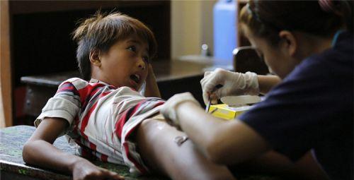 男孩就一定要割包皮吗? “这一刀”到底该不该割?