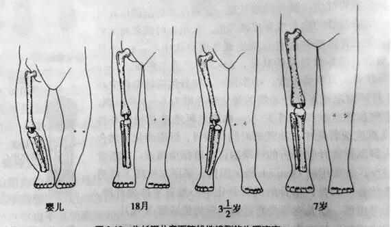 宝宝腿型正常不正常?