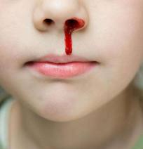 专家的披露孩子这4个症状,是白血病早期信号!