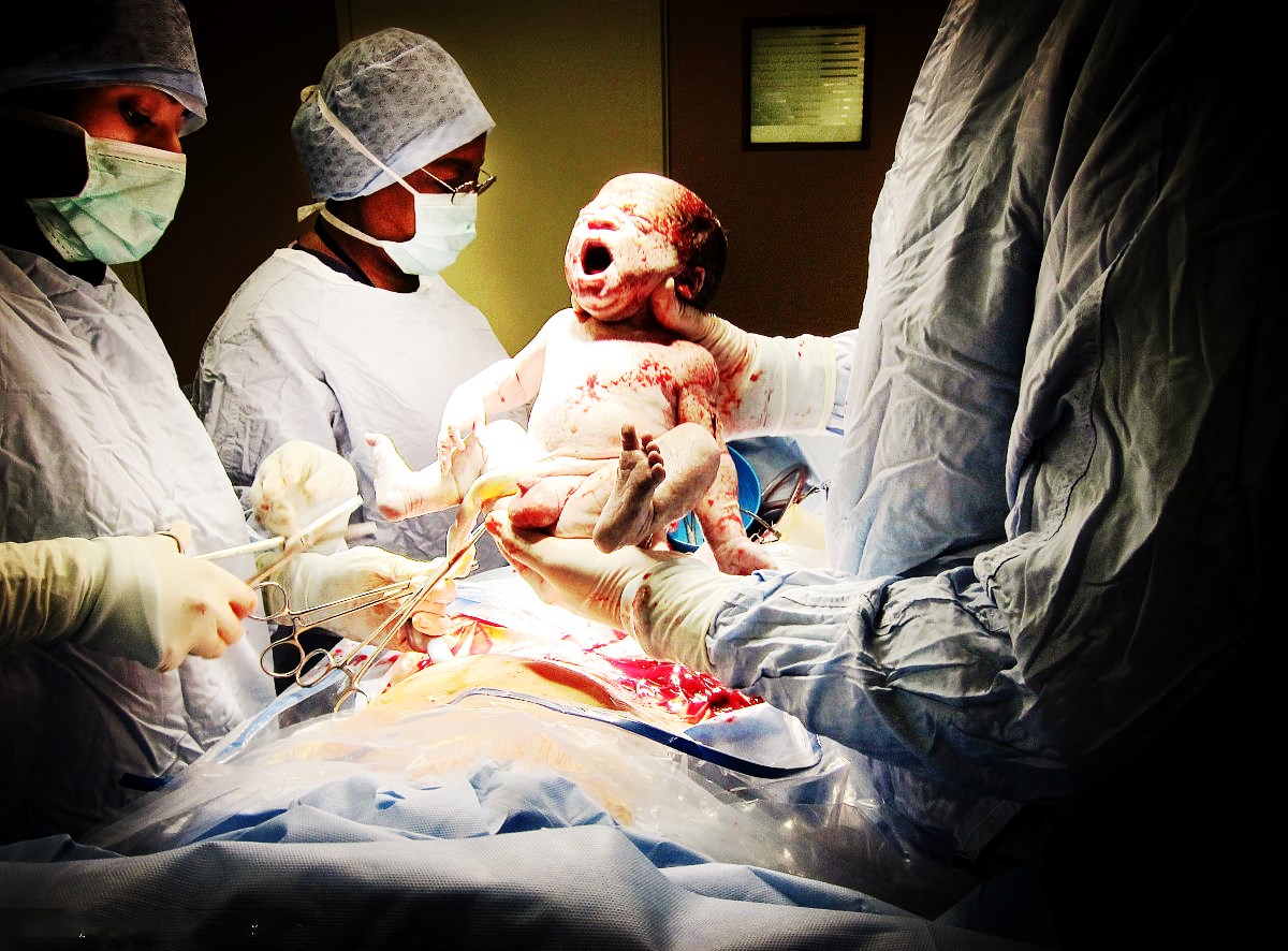 丈夫想要女儿,买转胎丸给妻子吃,结果生了个怪物,真是