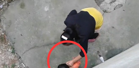 3岁宝宝一走路就哭,医生从脚底取出一样东西,