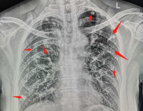 后悔为病人节约200元,老主任痛苦自责:医生的