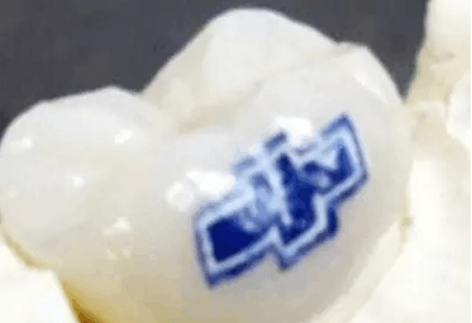 身体纹身已out, 现在流行纹牙你造吗