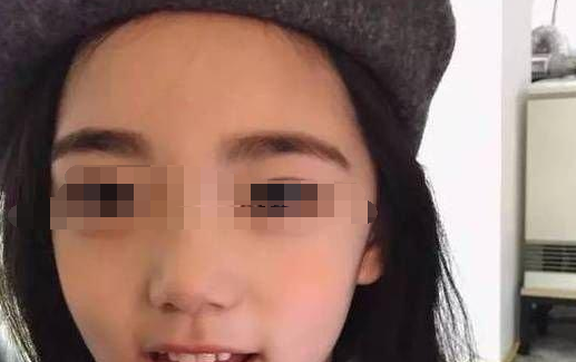 12岁女孩化妆6年,身高一直不长,经医院检查后