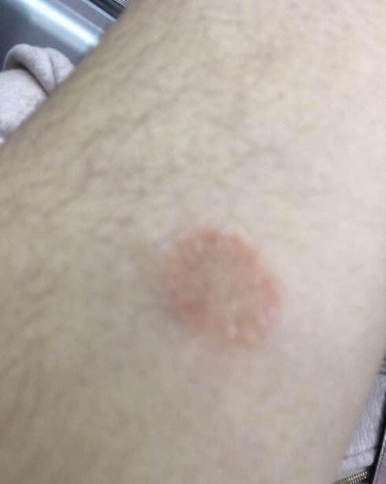 女孩养了猫以后,发现身上变成了这样,网友的话