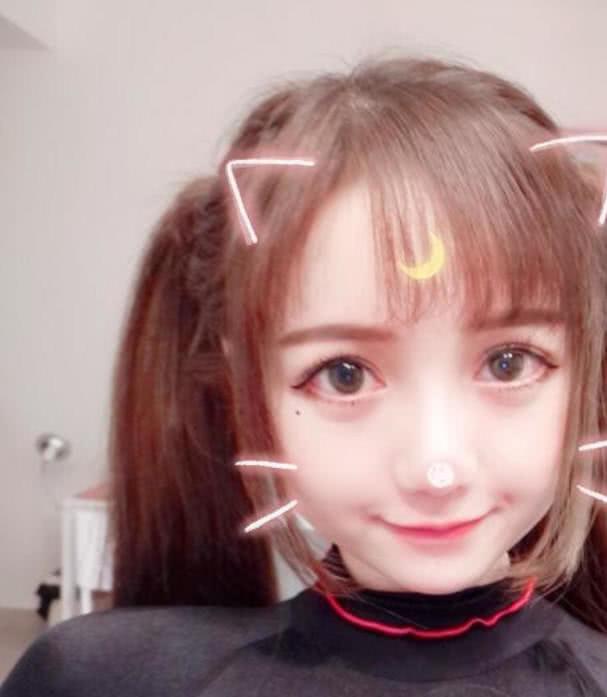 网红长相酷似迪丽热巴,因脸大自卑整容,手术失