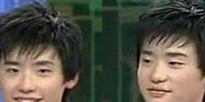 李钟硕整容前后照片对比 图文分析李钟硕哪些部位动过刀