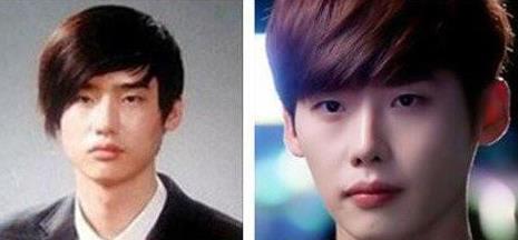 李钟硕整容前后照片对比 图文分析李钟硕哪些部位动过刀