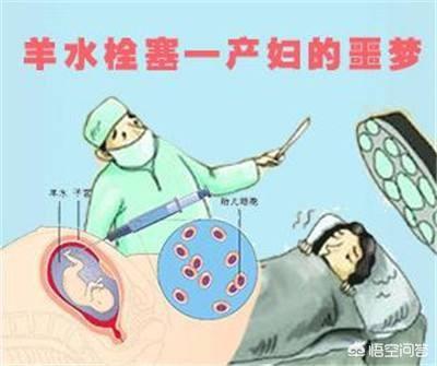 刘东强妹妹因羊水栓塞去世,对于作为产妇“致命恶魔”的它到底有