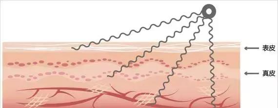 美容仪原理篇,网红美容仪真的有用吗?