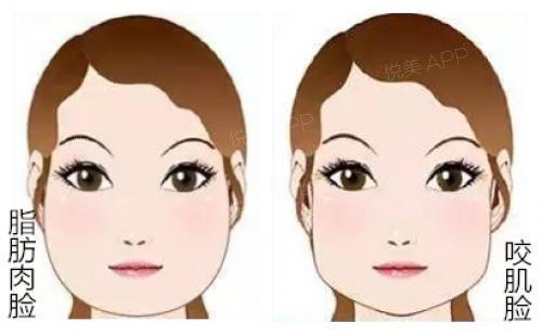 抖音里最火的瘦脸神器, 一秒拯救大饼脸真的好