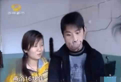 90后美女恋上“河马人”不离不弃 网友：终于找到了真爱