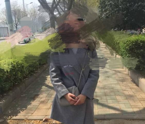 考研笔试前三也没录取, 因为脸上的红东西