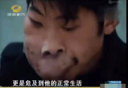 90后美女恋上“河马人”不离不弃 网友：终于找到了真爱