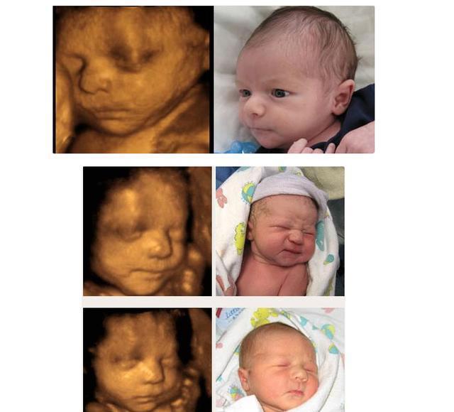 宝宝四维照片和出生后对比照, 宝宝你们太萌了