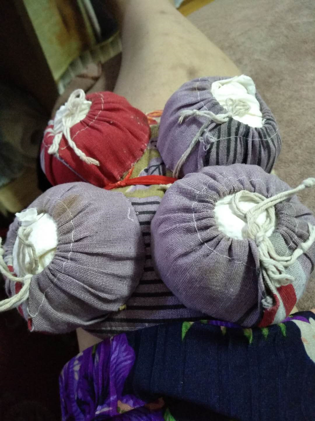 哺乳期关节疼痛,粗艾条熏灸患处(62)