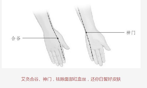 面部的红血丝,轻轻一灸就消失(26)