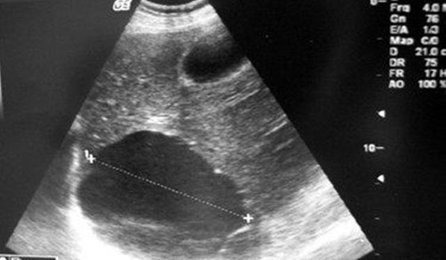 怀孕测男女的几种很准的方法,快看看你怀的是