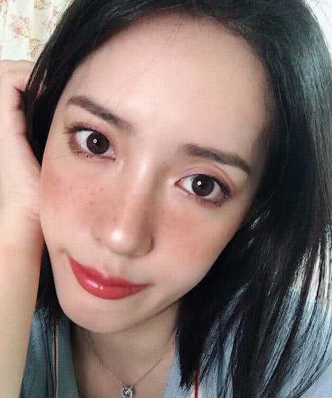 祛斑得分类型,有些真祛不掉,网友:雀斑女人更可爱时髦