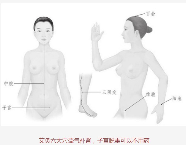 子宫脱垂的艾灸调理方法(41)