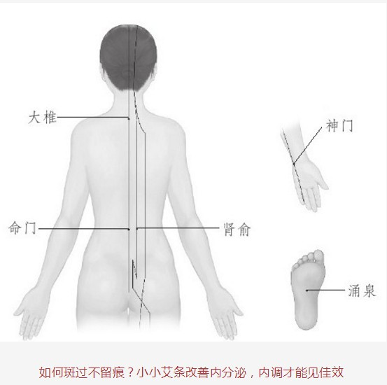 灸除百病的智慧(19)调好内分泌颜面更亮丽