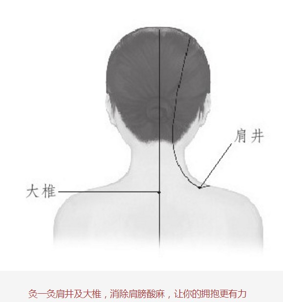 肩周炎、五十肩、肩凝都可以试试艾灸热灸贴