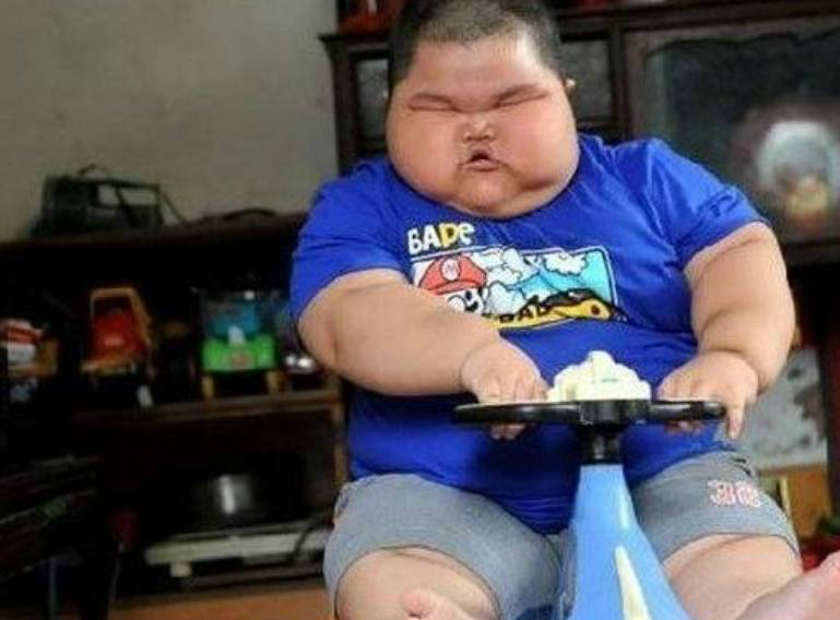 胖到眼睛都睁不开,号称中国最胖小孩,体重已经破150斤