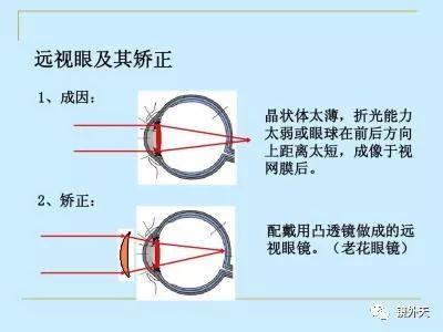 远视的原理？危害？如何快速的发现远视并改善？