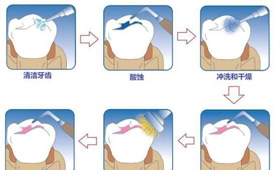 小烂牙激增!开学了快看看孩子的牙齿变成啥