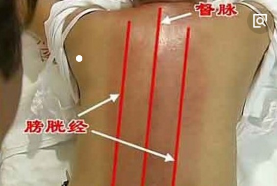 心烦焦虑情绪低,艾灸顺气防抑郁