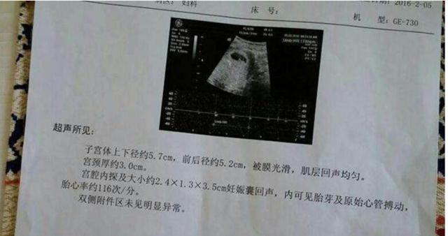听胎儿心跳辨别是男是女,孕妈们别不信,超准的