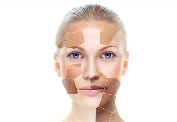 激素脸脱皮是快好了吧, 激素脸为什么一直脱皮