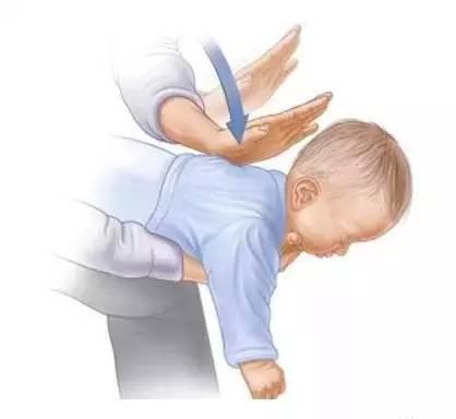 宝宝被噎住该如何急救,怎样才能防止宝宝异物