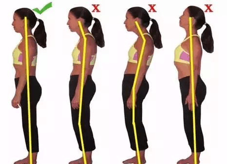 专家建议: 站姿正确, 腰椎间盘突就好一半了! 站