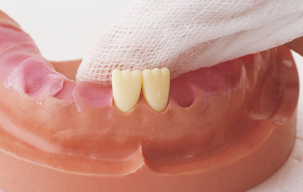 大牙图片 新浪网