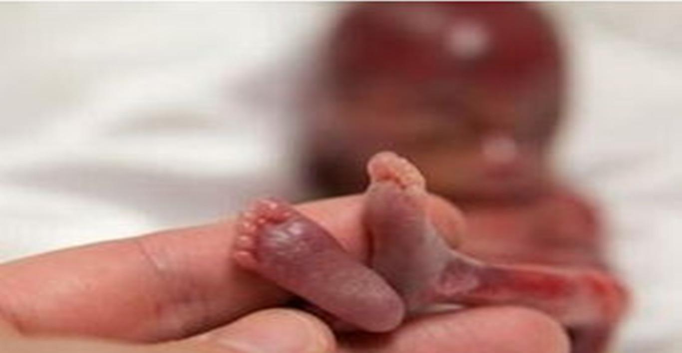 梦之殇，解析梦见自己流产了，还有成形的小人但小人是男孩死了的深层含义