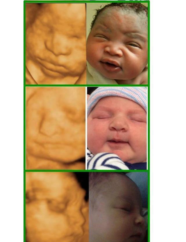 宝宝四维照片和出生后对比照, 宝宝你们太萌了