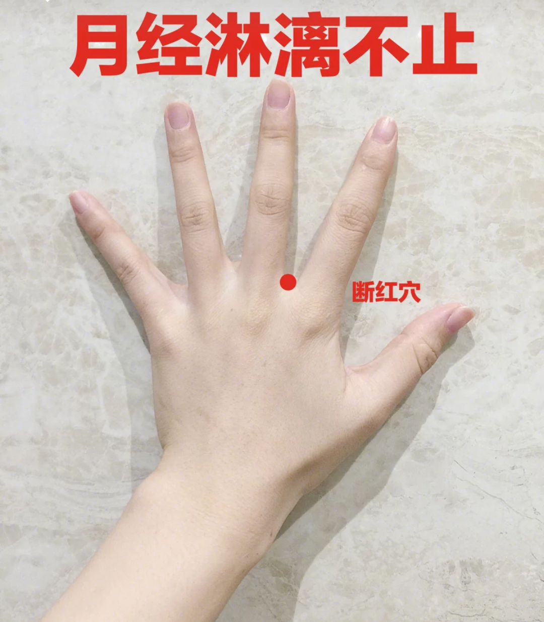 右手食指因工伤缺失能评几级伤残_凤凰网视频_凤凰网