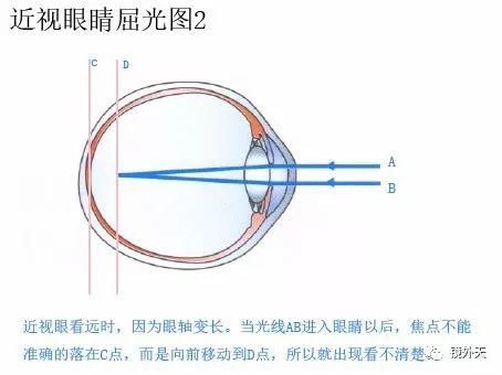 10个孩子7个近视，最伤眼“杀手”到底藏在哪里？