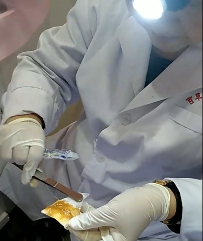 ?霉菌性阴道炎的艾灸调理方法(32)