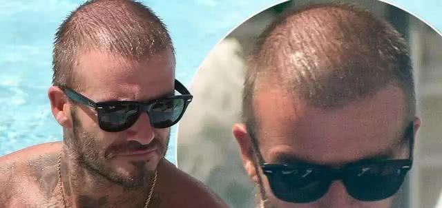 43岁贝克汉姆现状:成立俱乐部成老板,头发稀疏