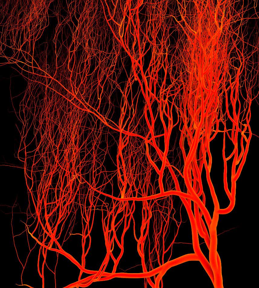 人到中年最怕血管堵?这些食物多吃点,疏通血管