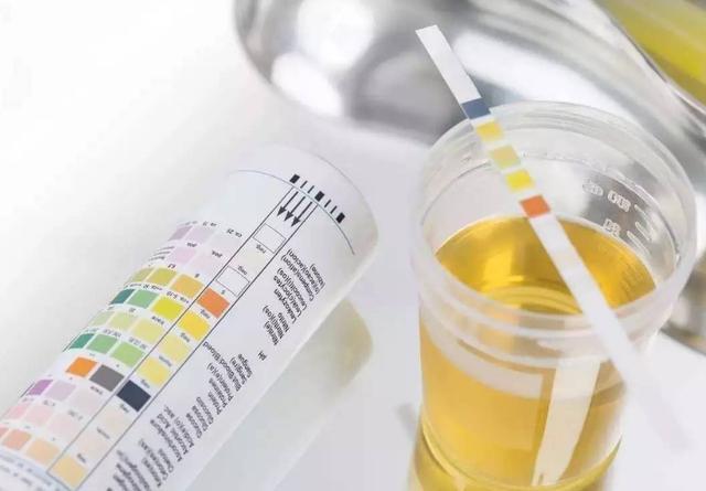 产检时候需留意,2种产妇需要反复尿常规检查,