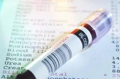 为什么抽血要空腹?喝了水算不算空腹?今天总