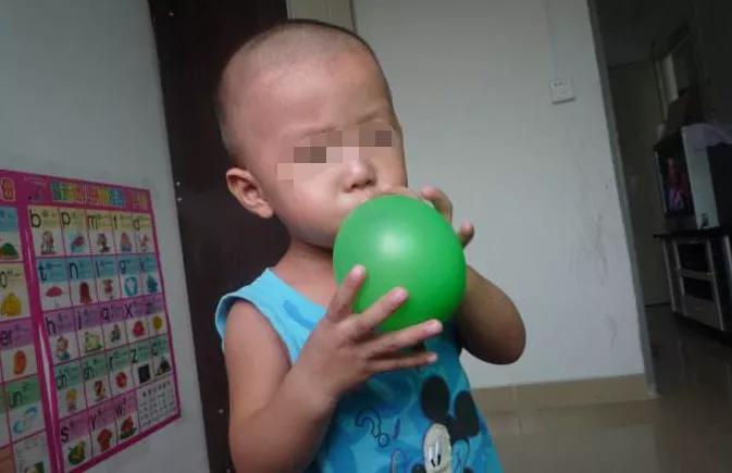儿子天天吹气球,父母怕他腮帮子疼,医生一查却