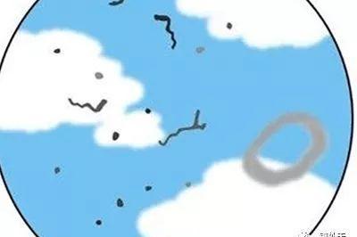 飞蚊症缓解方法 凝放护眼眼罩有用吗