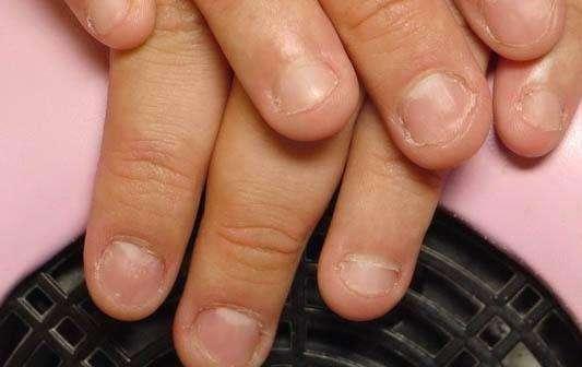 宝宝小手会说话:宝宝指甲有这些状况,那身体可能出问题了!
