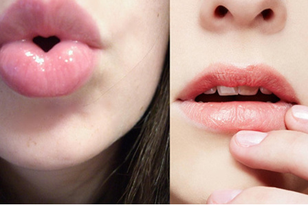 嘴唇周围黑色素沉淀是什么原因该如何改善