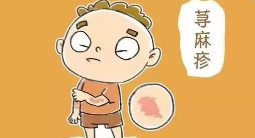 春季小儿荨麻疹高发期,不可忽视的8个因素,宝妈们赶紧收藏吧!